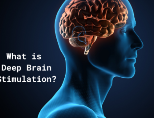 What is Deep Brain Stimulation?